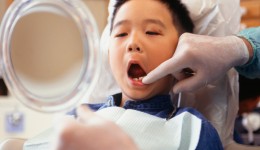 How safe are materials used to treat kids’ cavities?