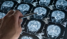 Using ultrasound to map brain function?