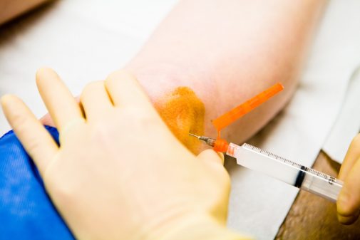Common cortisone shot questions answered