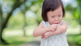 5 simple remedies to treat mosquito bites