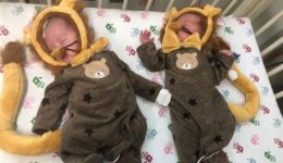 Cuteness overload: Our tiniest patients celebrate their first Halloween