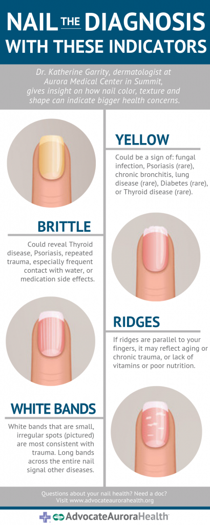 What your fingernails might say about your health | health enews