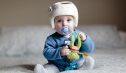 Does your baby need a helmet?