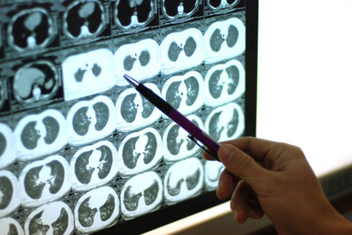 Did your imaging reveal a new health problem?