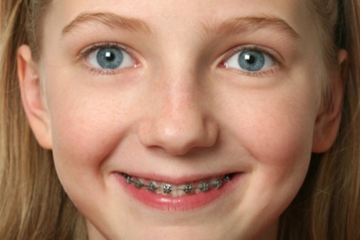 Bracing kids for braces