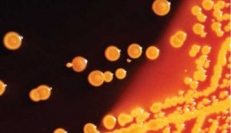 CDC warns against ‘lethal’ superbug
