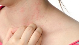 Is it a rash or psoriasis?