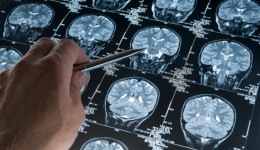 Alzheimer’s patients can now get treatment earlier