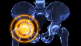 What your hip pain may be telling you