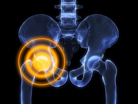 What your hip pain may be telling you