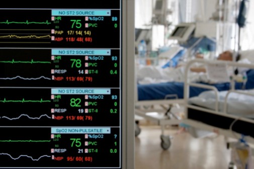 Can long ICU stays cause dementia?