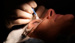 Why cataract surgeries are on the rise