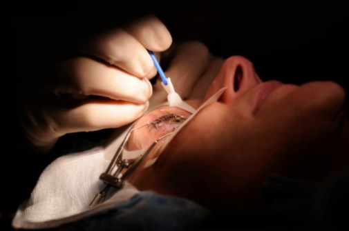 Why cataract surgeries are on the rise