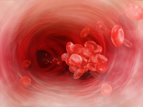Are you at risk for deep vein thrombosis?