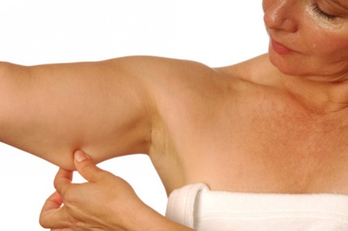 Arm lifts: The new trendy nip, tuck