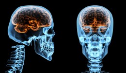 Anatomy of a brain injury