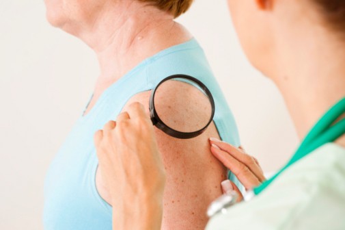 More moles could mean higher breast cancer risk
