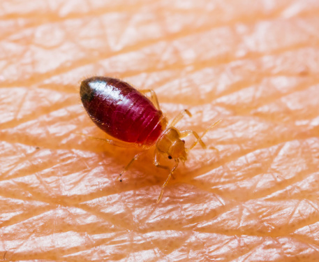 Keep your child safe from bedbug bites