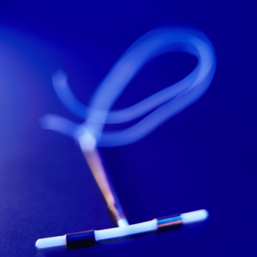 What you need to know about IUDs