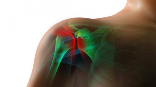 Rotator cuff injury can be debilitating