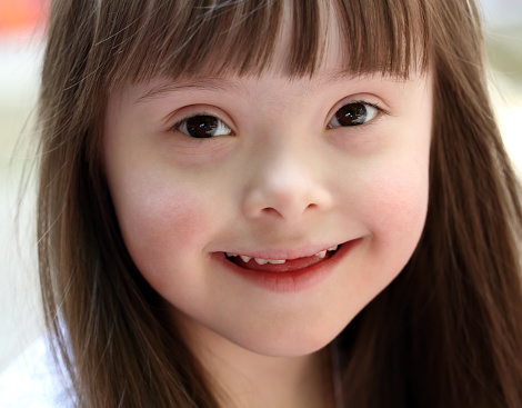 Infographic: 6 misconceptions about Down syndrome