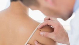 Your right arm could indicate your melanoma risk