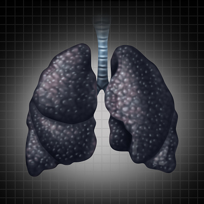 Infographic: Lung cancer in African American men