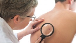 Are men more likely to get skin cancer?