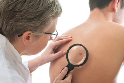 Are men more likely to get skin cancer?