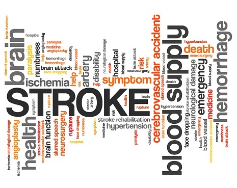 Being bilingual may help stroke patients