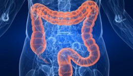 Obesity linked to colon cancer
