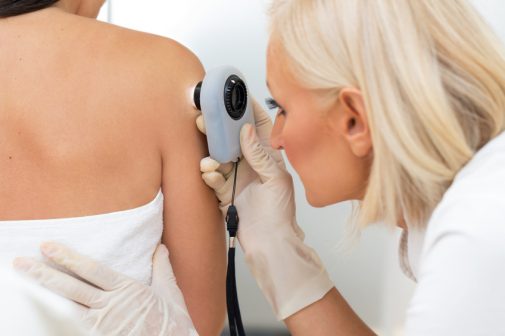 Do you need routine full-body skin cancer screenings?