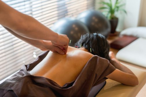 Is acupuncture right for you?