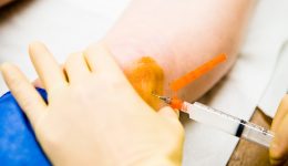 Common cortisone shot questions answered