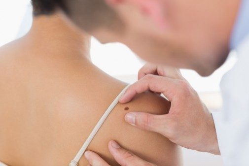 Your right arm could indicate your melanoma risk