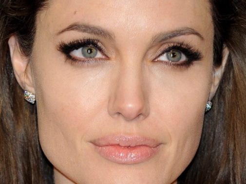 An inside look at Angelina Jolie’s rare condition