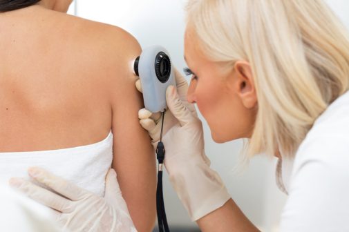 Doing this can increase your melanoma risk