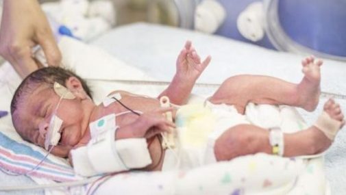 What happens if your baby is admitted to the NICU?