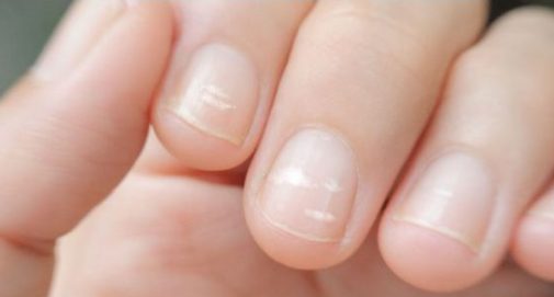 Could your fingernails indicate something more?