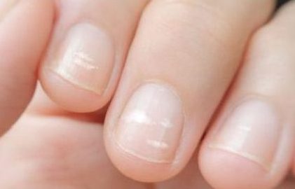 Could your fingernails indicate something more? | health enews