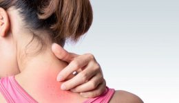 This skin irritation is common in hot weather
