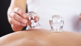 Some cupping therapy questions answered