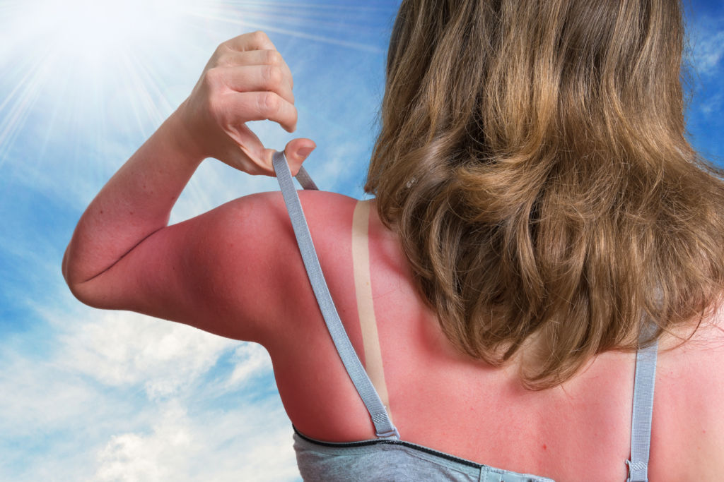 When you're out in the sun, it's better safe than sorry