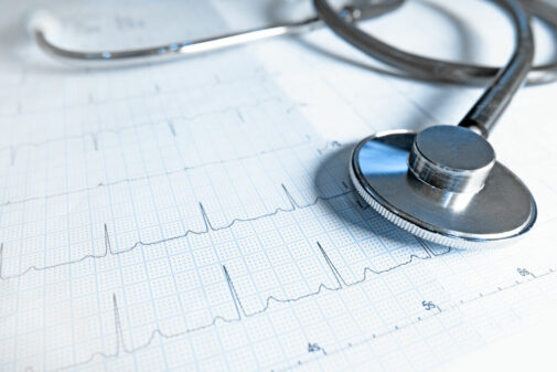 What is a pacemaker?