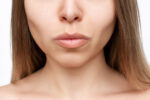A woman's slim face after buccal fat removal.