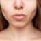 The basics of buccal fat removal