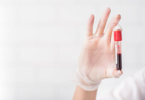 Here’s how to understand your blood tests