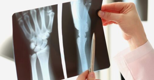 What you should know about x-rays