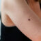 Protect yourself from these 3 common skin cancers