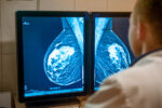 A doctor looking at a mammogram breast cancer screening.